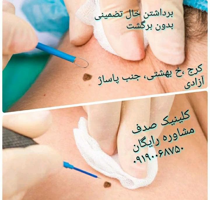 کلینیک زیبایی و لیزر موهای زائد صدف در کرج