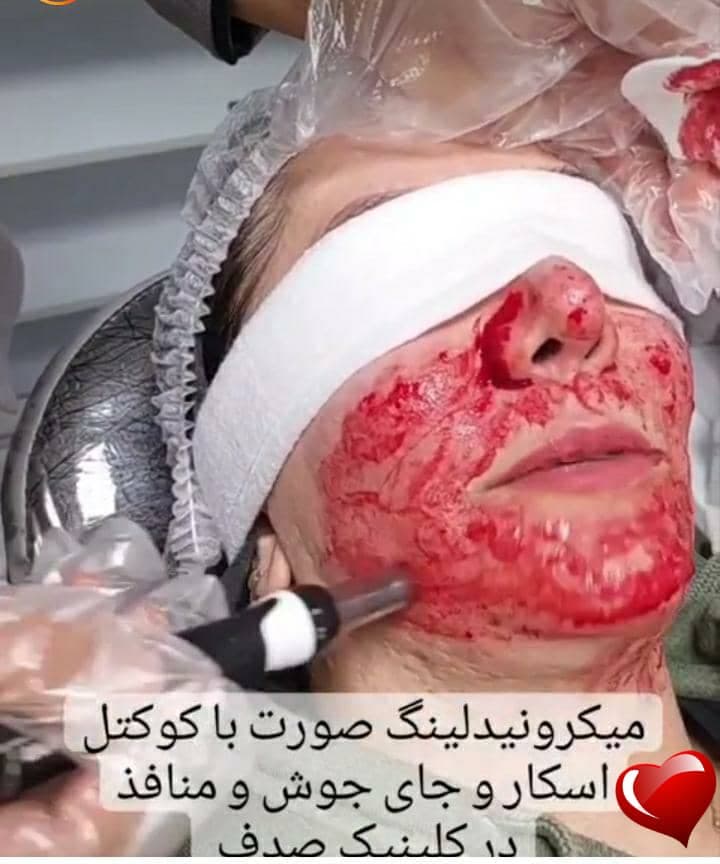 کلینیک زیبایی و لیزر موهای زائد صدف در کرج