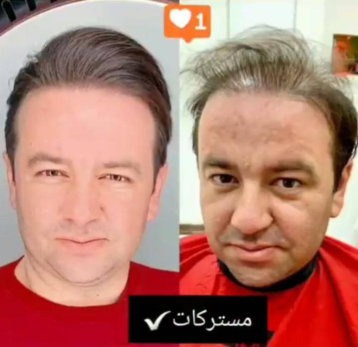مرکز تخصصی پروتز مو طبیعی مسترکات در کیش