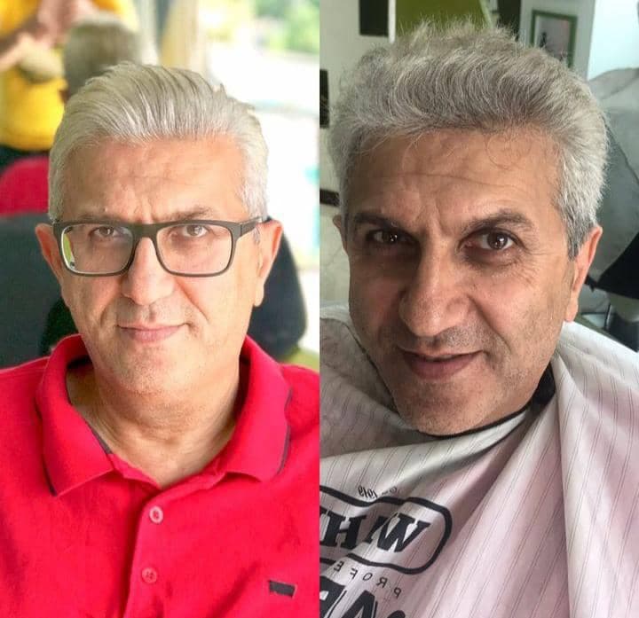 مرکز تخصصی پروتز مو طبیعی مسترکات در کیش