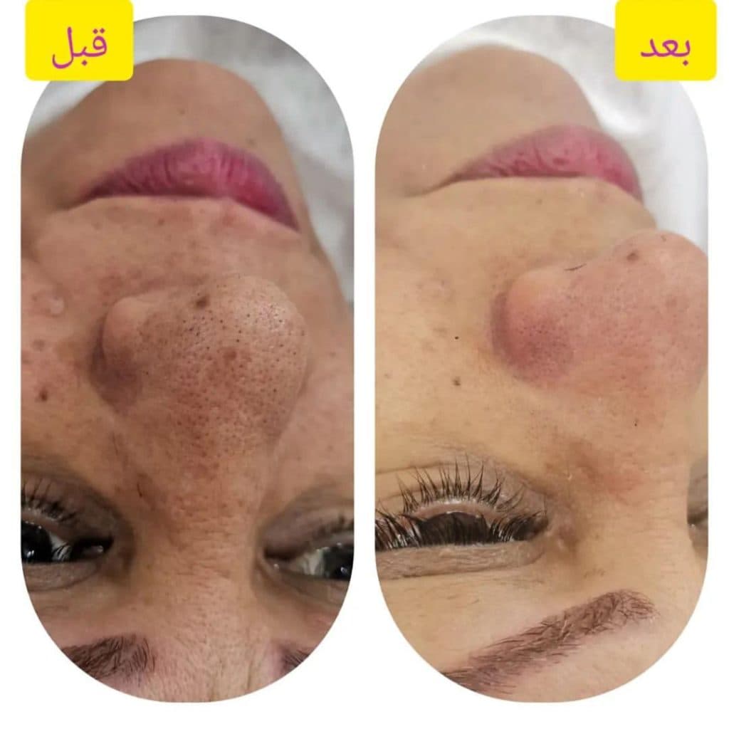 سالن زیبایی ترمه گرامی در گرگان