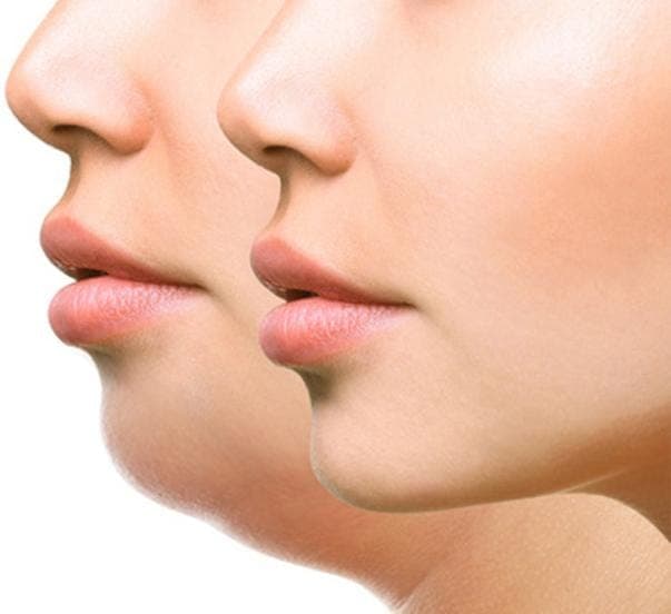 خدمات درمان زگیل تناسلی و ترمیم ‌و لیزر و هایفو درسا در خرم آباد