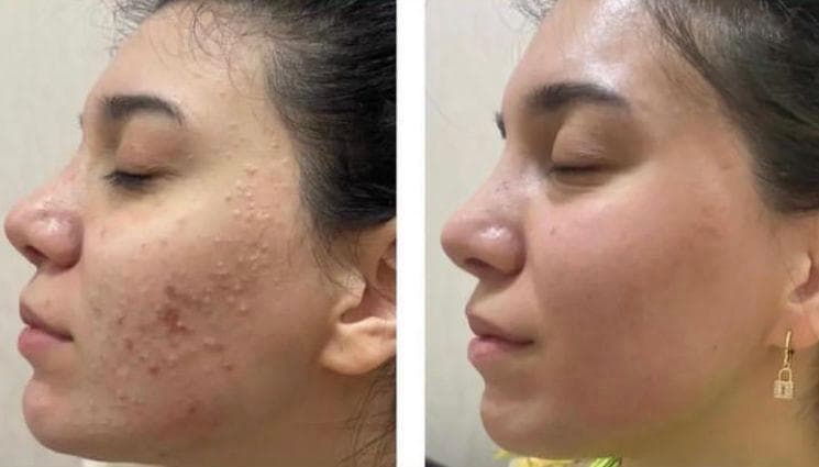 مرکز زیبایی پوست و لیزر و فیشال مون فیس در شیراز