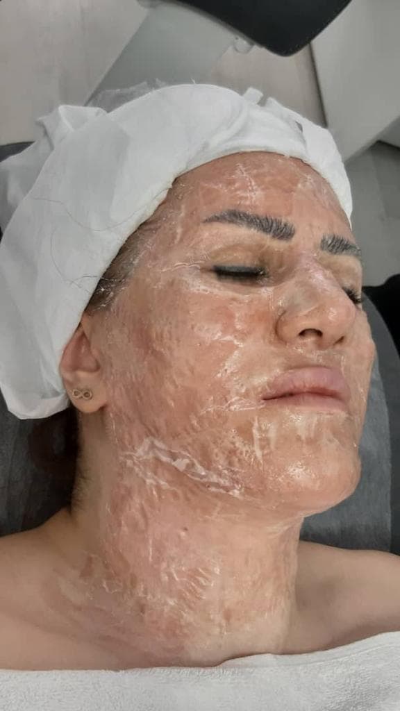 کلینیک زیبایی آیما در سعادت آباد تهران