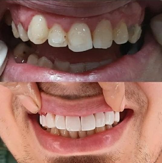 مطب دندانپزشکی دکتر هدیه هدایت زاده در رشت