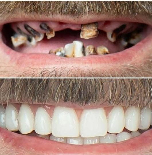 مطب دندانپزشکی دکتر هدیه هدایت زاده در رشت