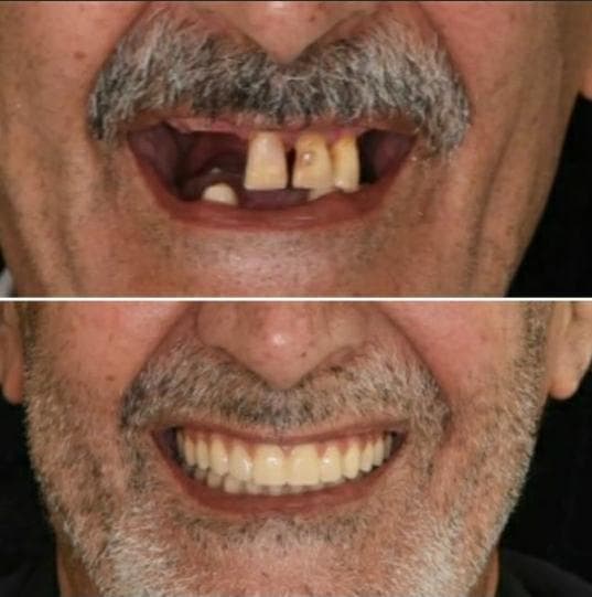 مطب دندانپزشکی دکتر هدیه هدایت زاده در رشت