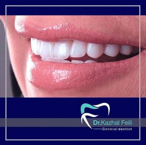مطب دندانپزشکی دکتر کژال فیلی در سنندج کامیاران