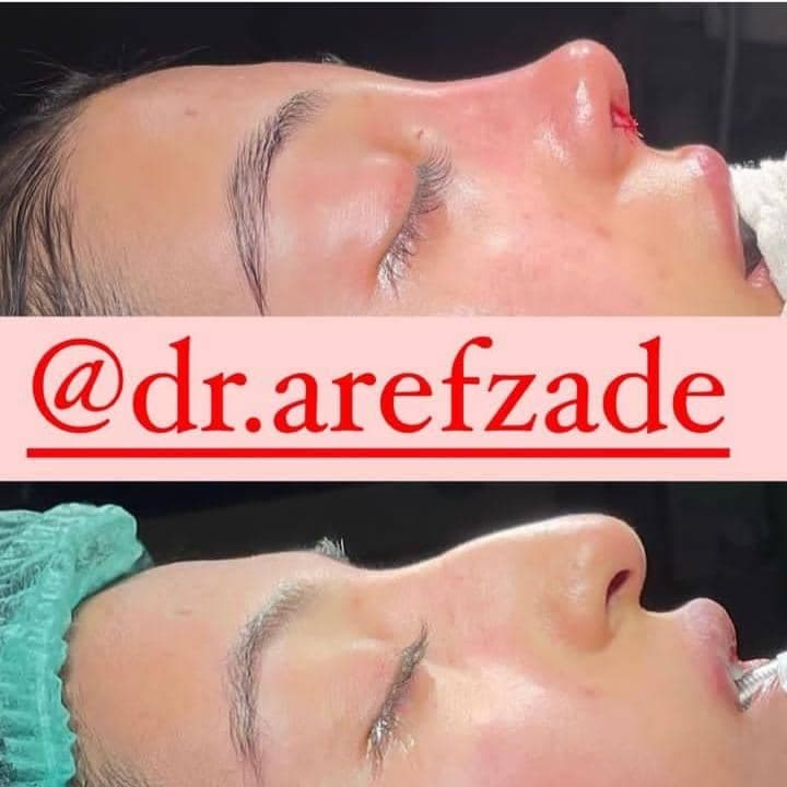 دکتر اسماعیل عارف زاده متخصص گوش حلق بینی در قائم شهر مازندران
