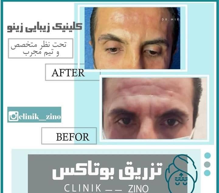کلینیک زیبایی زینو در برازجان بوشهر