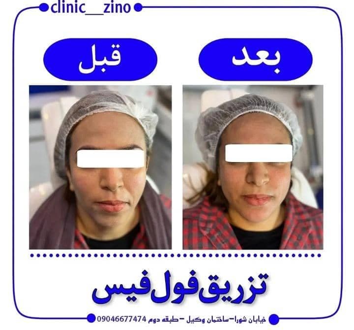 کلینیک زیبایی زینو در برازجان بوشهر