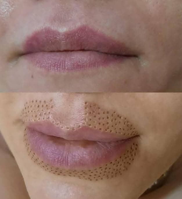 کلینیک پوست و مو و لیزر سفیر در ری تهران