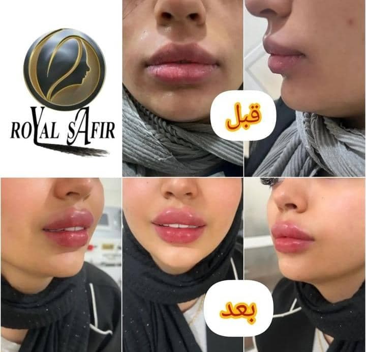 کلینیک پوست و مو و لیزر سفیر در ری تهران