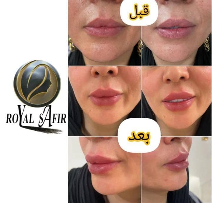 کلینیک پوست و مو و لیزر سفیر در ری تهران