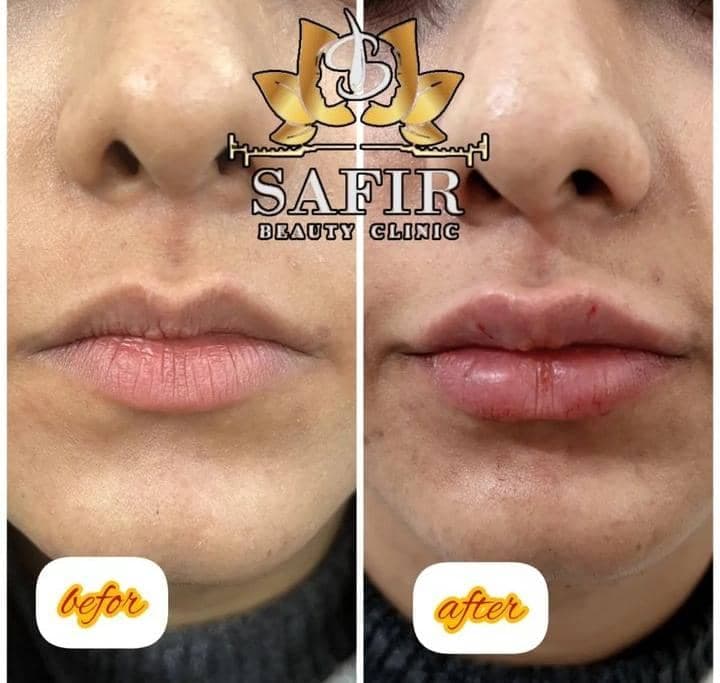 کلینیک پوست و مو و لیزر سفیر در ری تهران