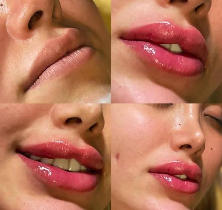 کلینیک زیبایی فیلر زرین در ساری