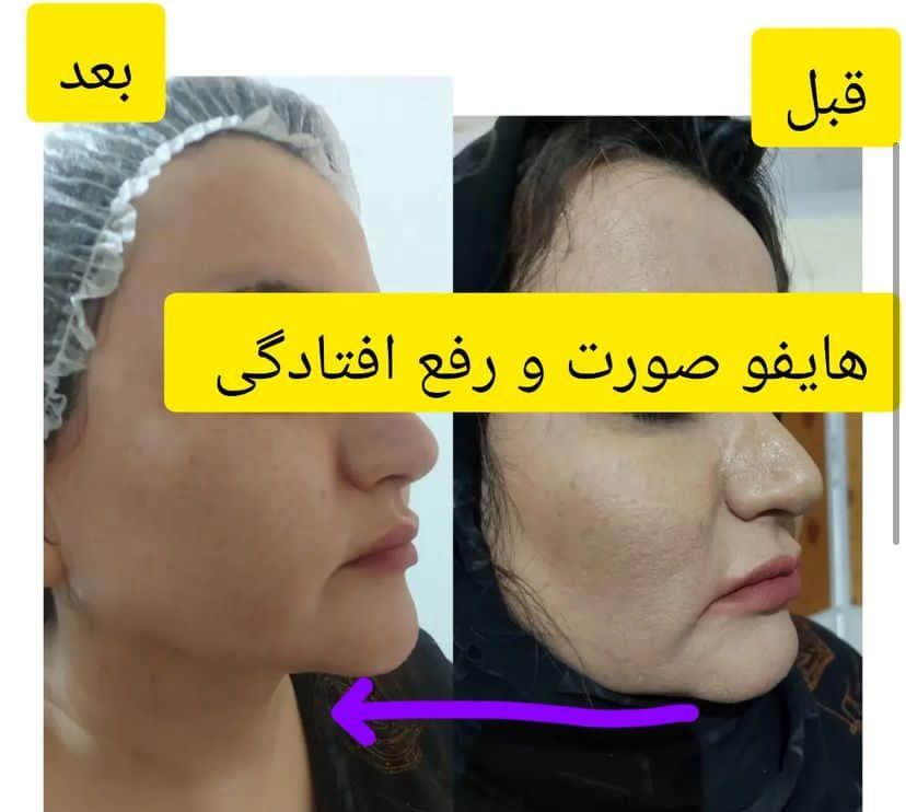 کلینیک زیبایی آدرینا در خرم آباد