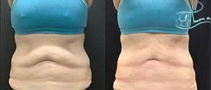 کلینیک لاغری پوست لیزر و زیبایی دکتر نیلوفر حسینی در گوهردشت کرج