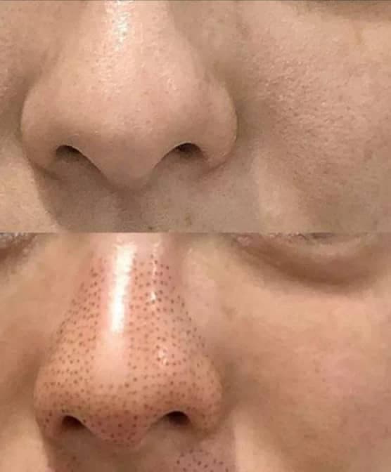 مرکز تخصصی پوست و مو فشیال مزونیدلینگ و پلاسما بیوتی M در هشتگرد جدید