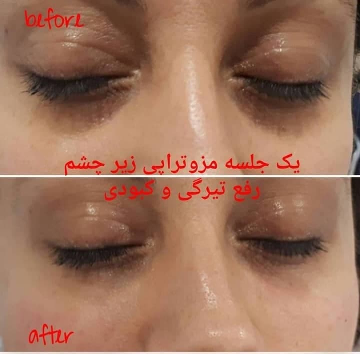 کلینیک زیبایی فردیس دکتر ندا بنواری در کرج