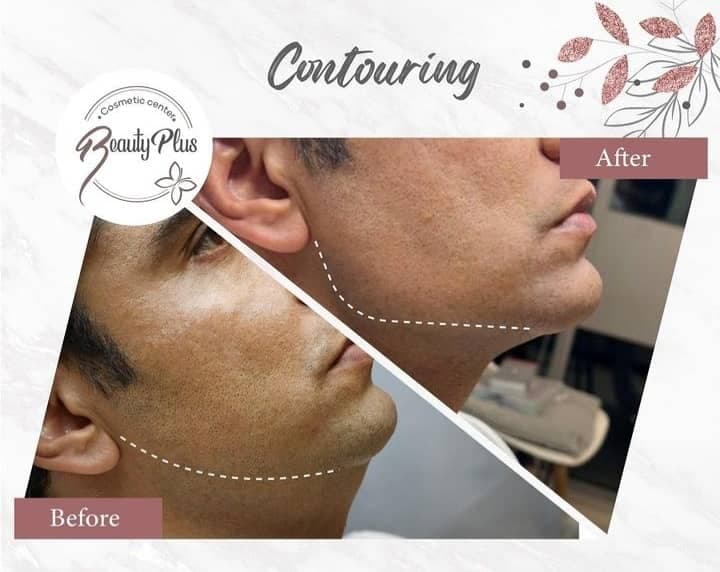 مطب زیبایی دکتر میلاد قبولی بیوتی پلاس در کرمان
