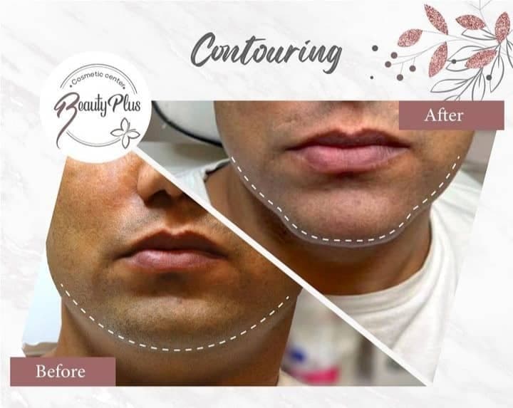 مطب زیبایی دکتر میلاد قبولی بیوتی پلاس در کرمان