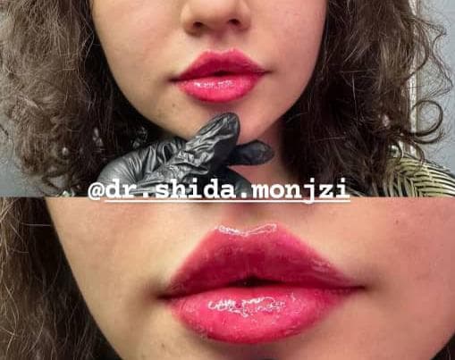 کلینیک تخصصی پوست و مو و زیبایی شیدا منجزی در شوشتر خوزستان