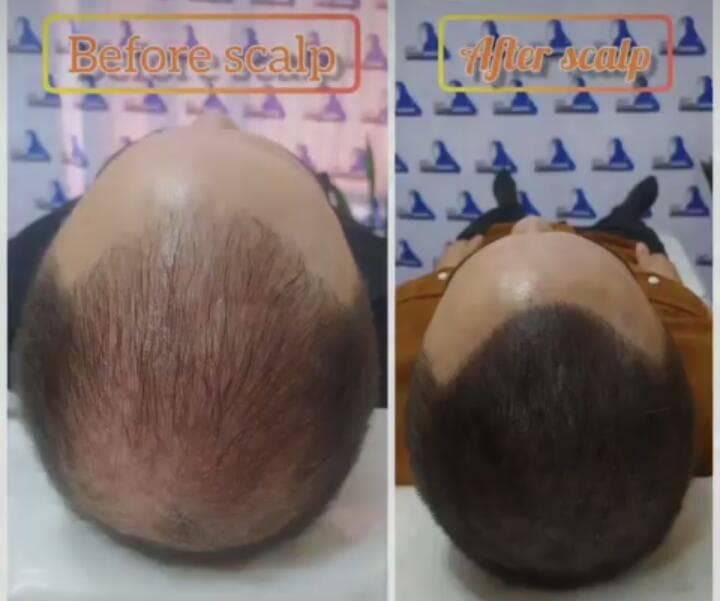 خدمات میکرواسکالپ و اسکالپ و میکروبلیدینگ اسکالپ سنتر در سنندج کردستان