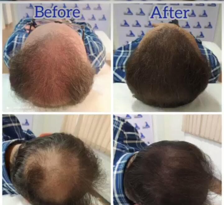 خدمات میکرواسکالپ و اسکالپ و میکروبلیدینگ اسکالپ سنتر در سنندج کردستان