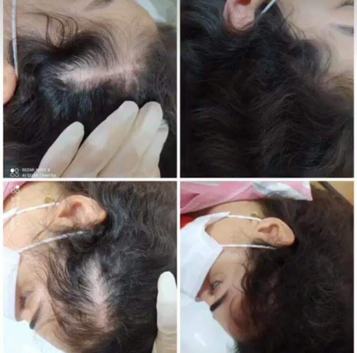 خدمات میکرواسکالپ و اسکالپ و میکروبلیدینگ اسکالپ سنتر در سنندج کردستان