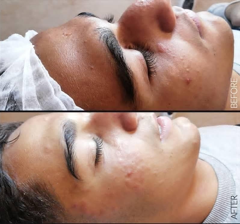 مرکز لیزر الکساندرایت و فشیال تخصصی پوست دشتی در معالی آباد شیراز