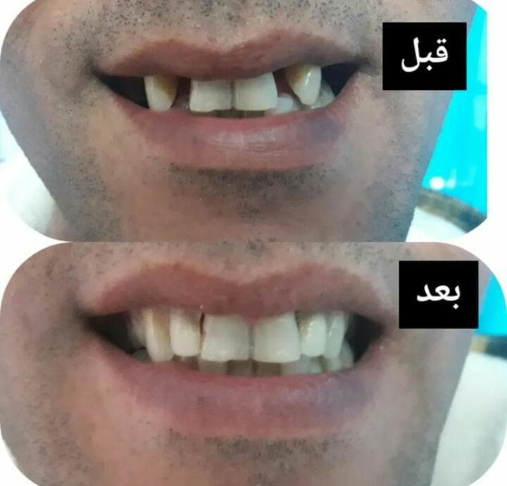 دندانسازی واعظی در عباس آباد مازندران