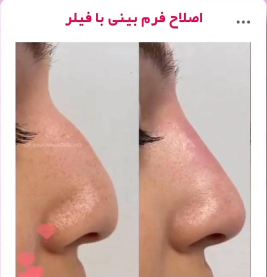 مطب زیبایی پوست و مو دکتر بینا احمدی نژاد در تهران