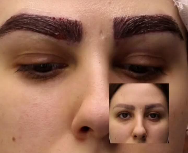 مطب زیبایی پوست و مو دکتر میترا خسرو طبع در تبریز