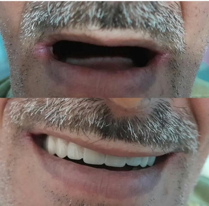 دندانسازی واعظی در عباس آباد مازندران