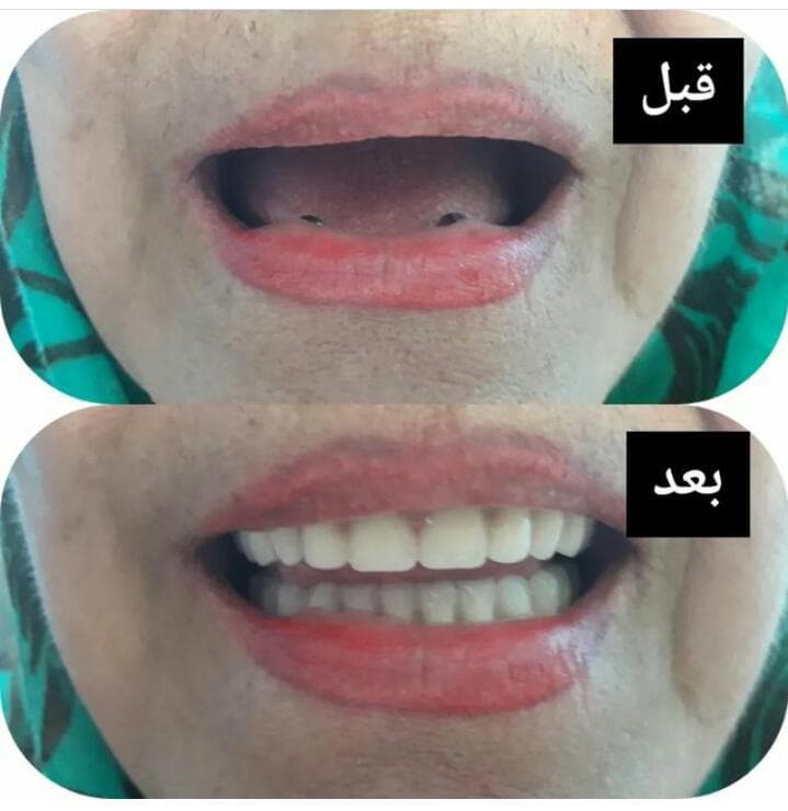دندانسازی واعظی در عباس آباد مازندران