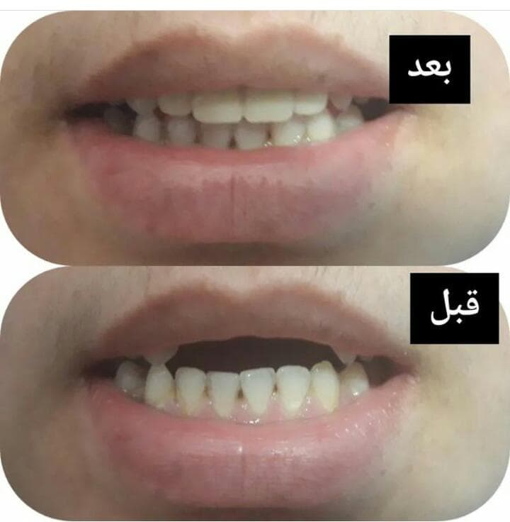 دندانسازی واعظی در عباس آباد مازندران