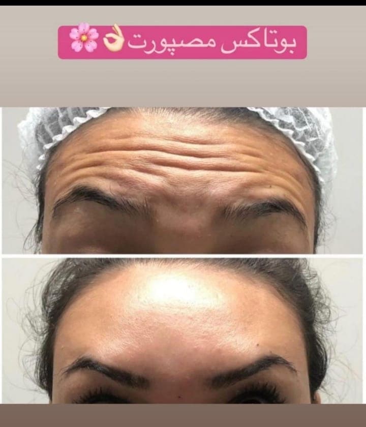 کلینیک زیبایی آدرینا در خرم آباد