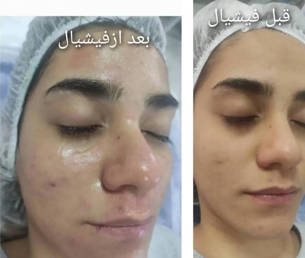 کلینیک مراقبتی پوست و مو آذین در کرمان