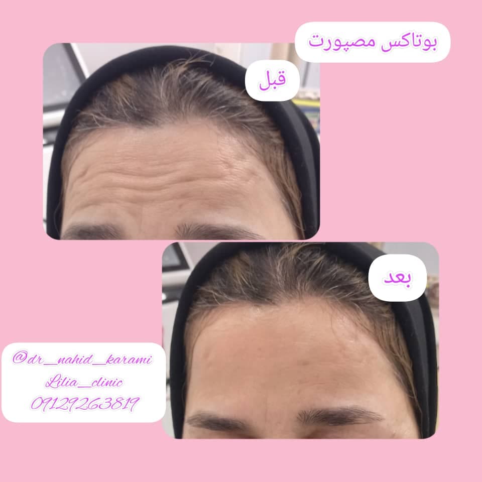 کلینیک زیبایی و لیزر لیلیا در برازجان بوشهر