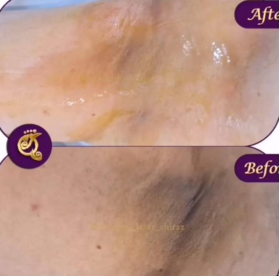 مرکز تخصصی لیزر و زیبایی فشیال و لاغری لیلا خوشرو در معالی آباد شیراز