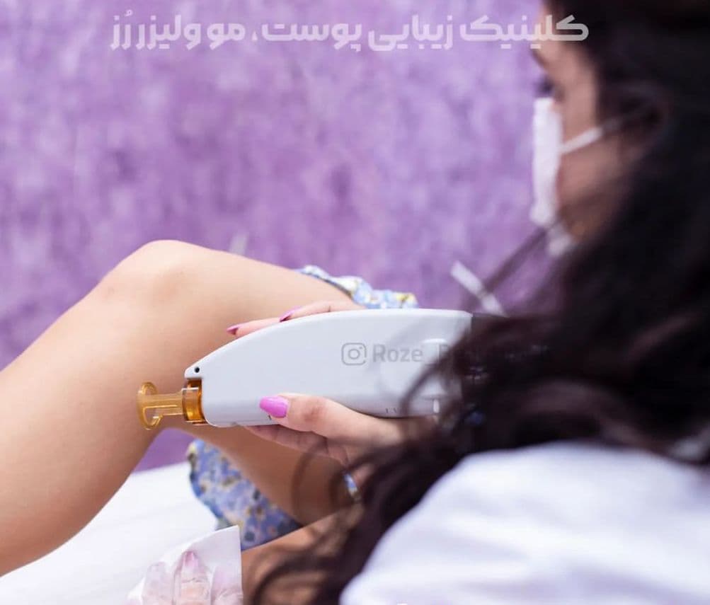 مرکز تخصصی لیزر رز در همدان