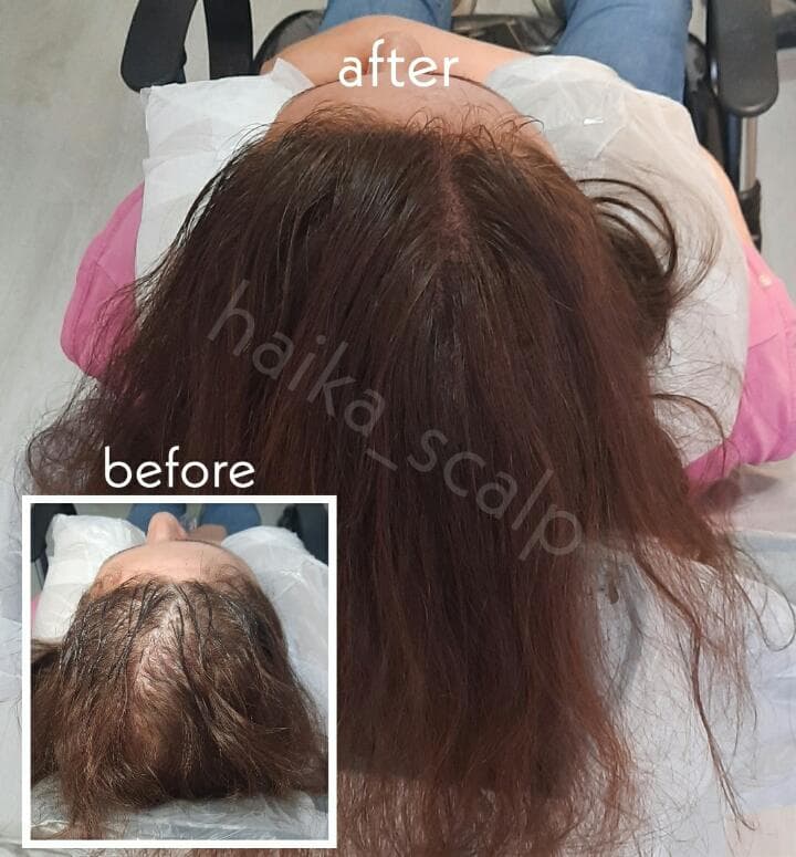 مرکز تخصصی میکرواسکالپ و اسکالپ سر و اسکالپ اسپرت هایکا در شیراز