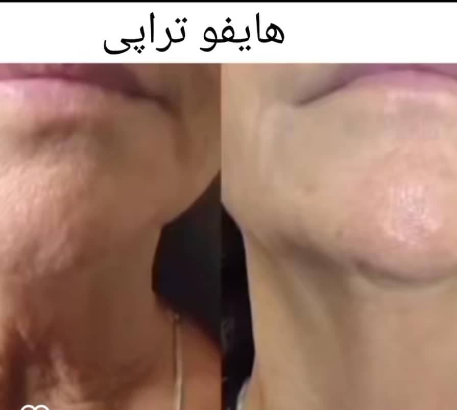 کلینیک مراقبتی پوست و مو آذین در کرمان