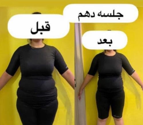 باشگاه لاغری ems صدف در تهران