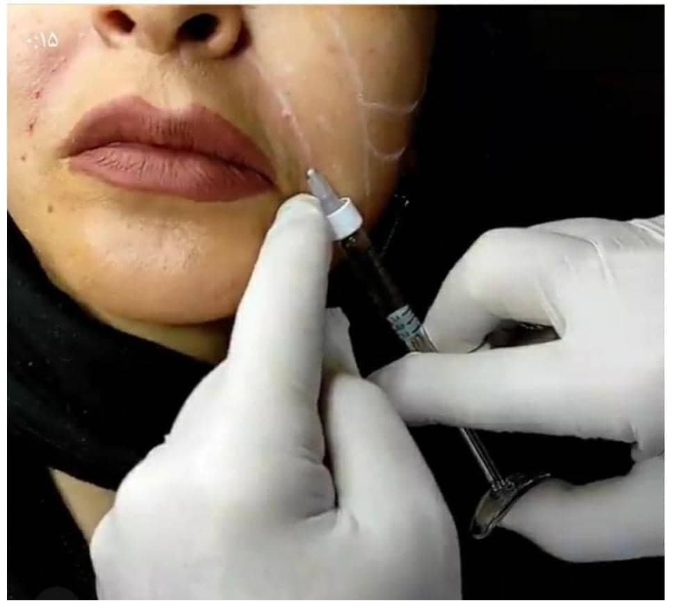 کلینیک و خدمات زیبایی دکتر نادر صالحی حقی در قزوین
