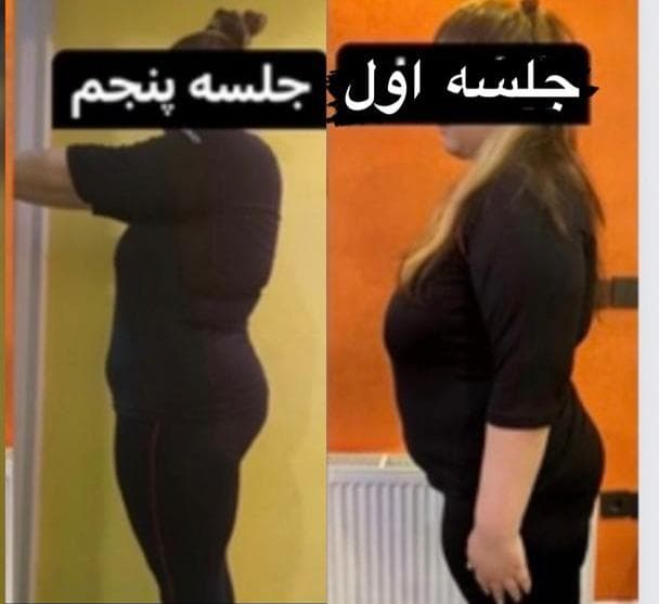باشگاه لاغری ems صدف در تهران