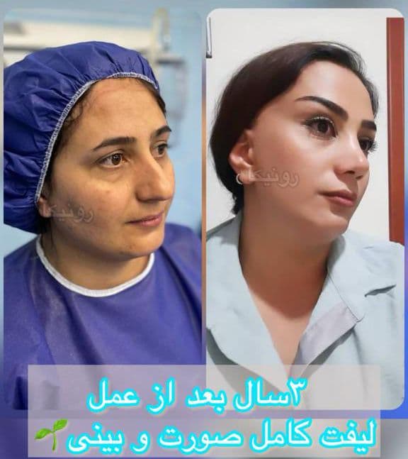 کلینیک جراحی رونیکا در تهران