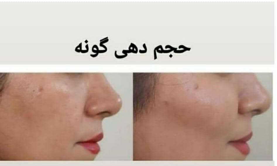 کلینیک و خدمات زیبایی دکتر نادر صالحی حقی در قزوین