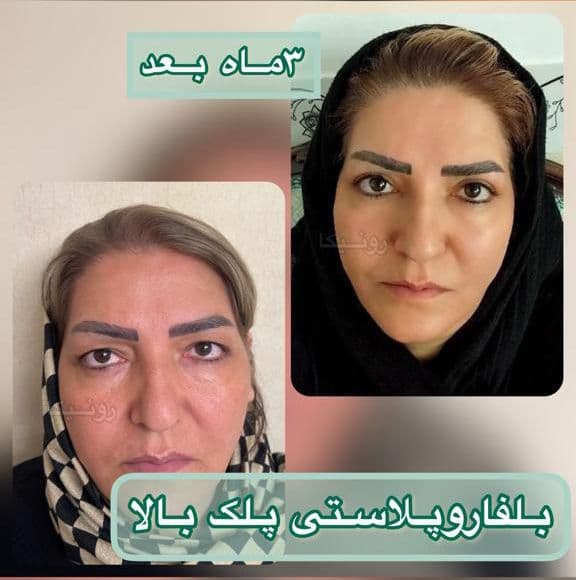 کلینیک جراحی رونیکا در تهران